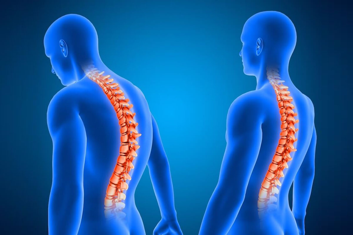 Come imparare a valutare, considerare e correggere la postura